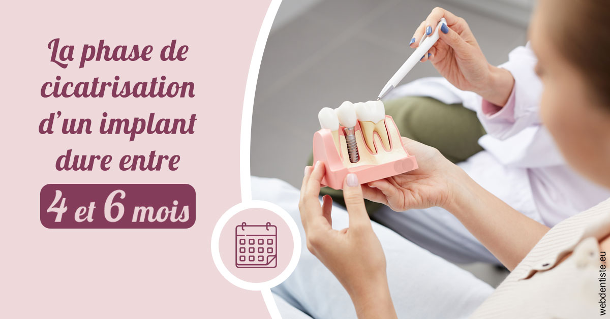 https://dr-reich-cyril.chirurgiens-dentistes.fr/Cicatrisation implant 2