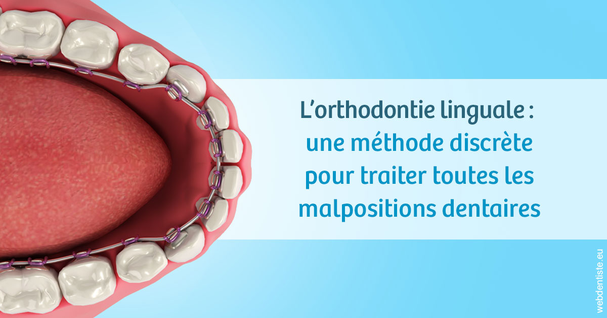 https://dr-reich-cyril.chirurgiens-dentistes.fr/L'orthodontie linguale 1