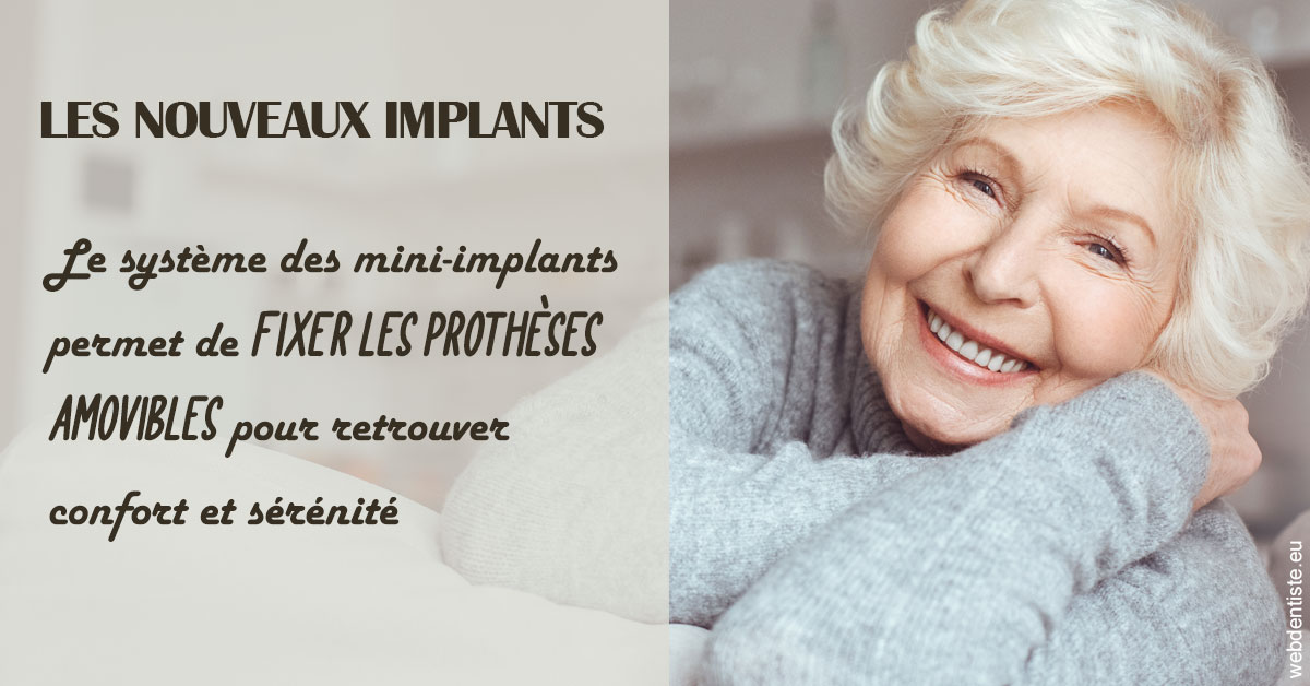https://dr-reich-cyril.chirurgiens-dentistes.fr/Les nouveaux implants 1