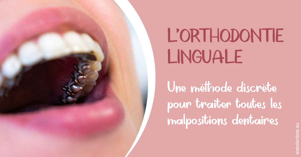 https://dr-reich-cyril.chirurgiens-dentistes.fr/L'orthodontie linguale 2