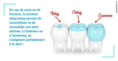 https://dr-reich-cyril.chirurgiens-dentistes.fr/L'INLAY ou l'ONLAY