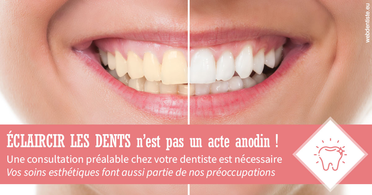 https://dr-reich-cyril.chirurgiens-dentistes.fr/Eclaircir les dents 1