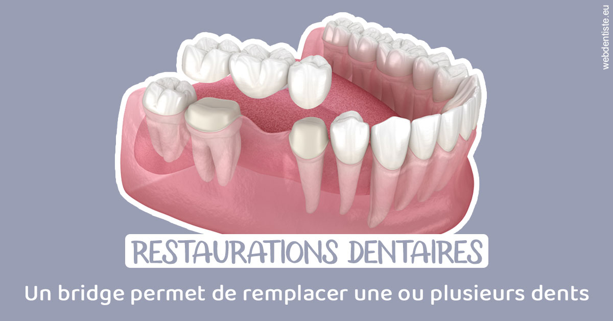 https://dr-reich-cyril.chirurgiens-dentistes.fr/Bridge remplacer dents 1