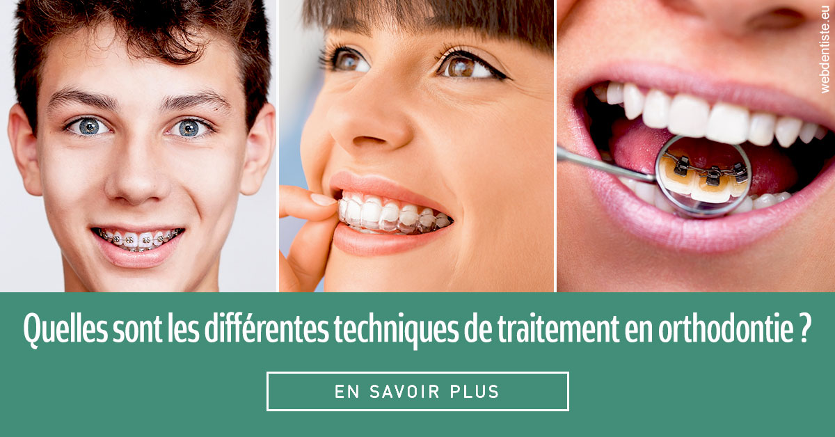 https://dr-reich-cyril.chirurgiens-dentistes.fr/Les différentes techniques de traitement 2