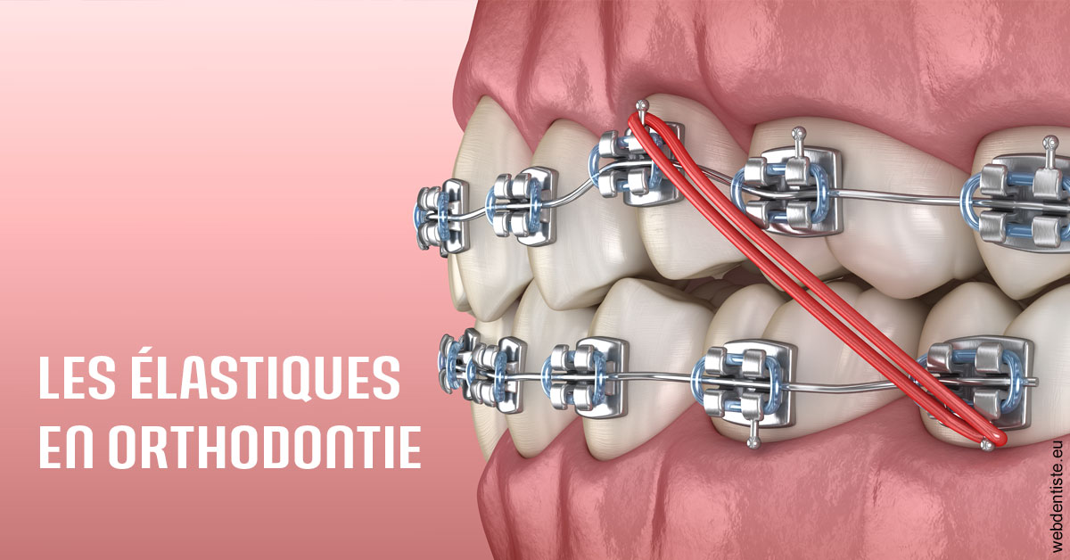 https://dr-reich-cyril.chirurgiens-dentistes.fr/Elastiques orthodontie 2