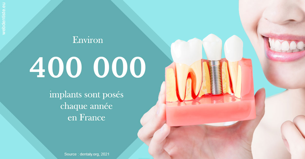 https://dr-reich-cyril.chirurgiens-dentistes.fr/Pose d'implants en France 2